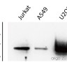 Антитела anti-PKM1/2 antibody, кроличьи поликлональные, Arigobio