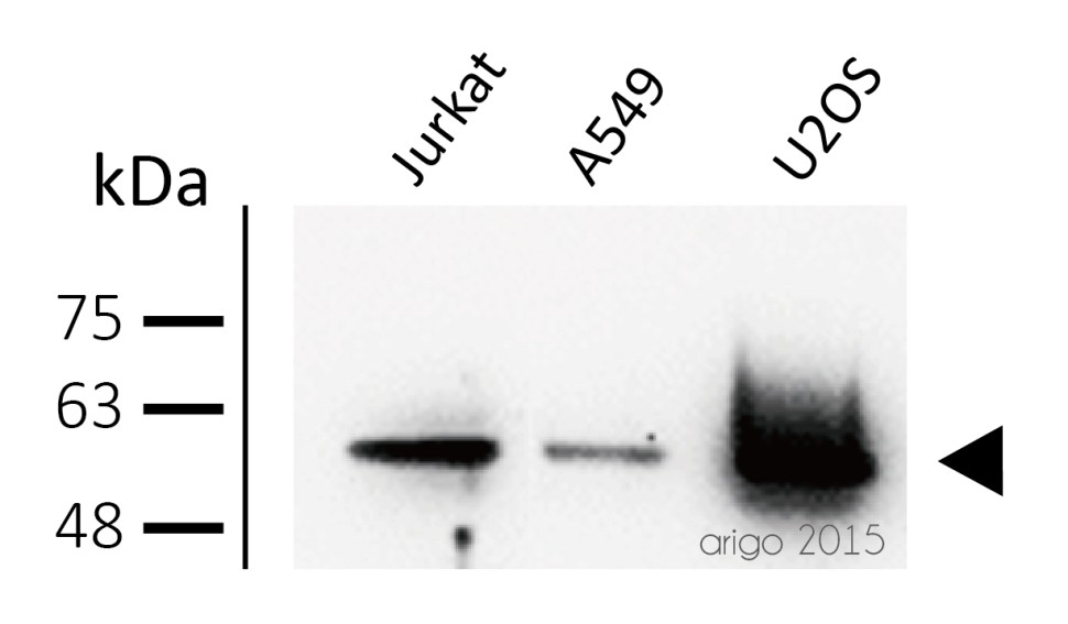 Антитела anti-PKM1/2 antibody, кроличьи поликлональные, Arigobio