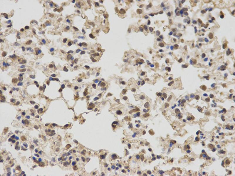 Антитела anti-PKM1/2 antibody, кроличьи поликлональные, Arigobio