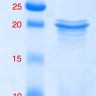 Интерлейкин 2 человека, рекомбинантный белок, rhIL-2, Россия