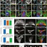 Система многопараметрического анализа клеток CellInsight 7, 7 каналов детекции, Thermo FS (аналог арт. CELENA X, Logos Biosystems)