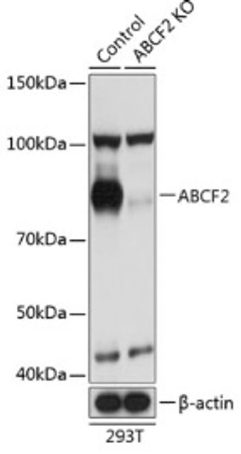 Антитела [KO Validated] ABCF2 кроличьи, поликлональные, ABclonal (DM_A19949.20ul)