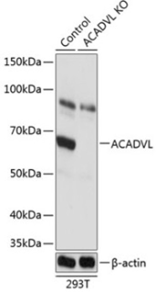 Антитела [KO Validated] ACADVL кроличьи, поликлональные, ABclonal