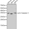 Антитела [KO Validated] active + pro Caspase-3 кроличьи, моноклональные, ABclonal