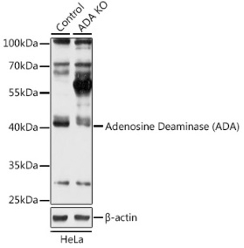 Антитела [KO Validated] Adenosine Deaminase (ADA) кроличьи, поликлональные, ABclonal