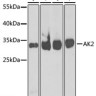 Антитела [KO Validated] AK2 кроличьи, поликлональные, ABclonal