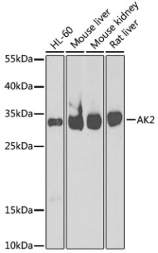 Антитела [KO Validated] AK2 кроличьи, поликлональные, ABclonal