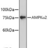 Антитела [KO Validated] AMPKα2 кроличьи, поликлональные, ABclonal