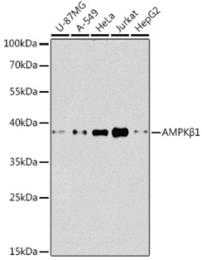 Антитела [KO Validated] AMPKβ1 кроличьи, поликлональные, ABclonal