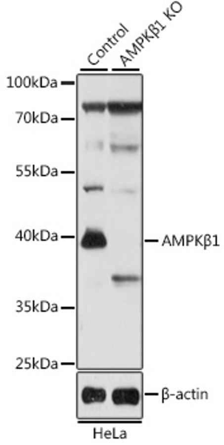 Антитела [KO Validated] AMPKβ1 кроличьи, поликлональные, ABclonal