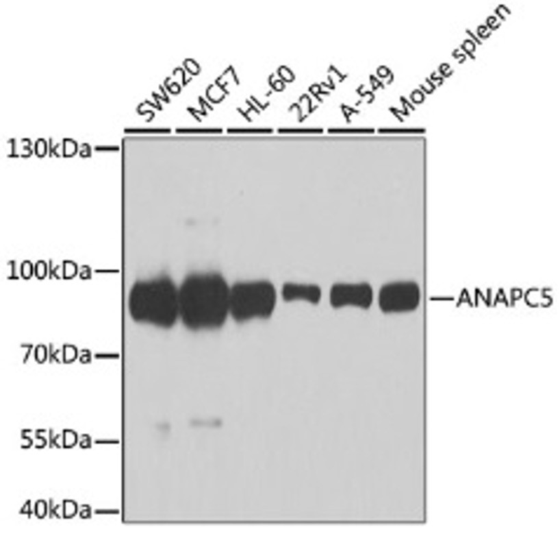 Антитела [KO Validated] ANAPC5 кроличьи, поликлональные, ABclonal