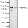 Антитела [KO Validated] ANAPC5 кроличьи, поликлональные, ABclonal