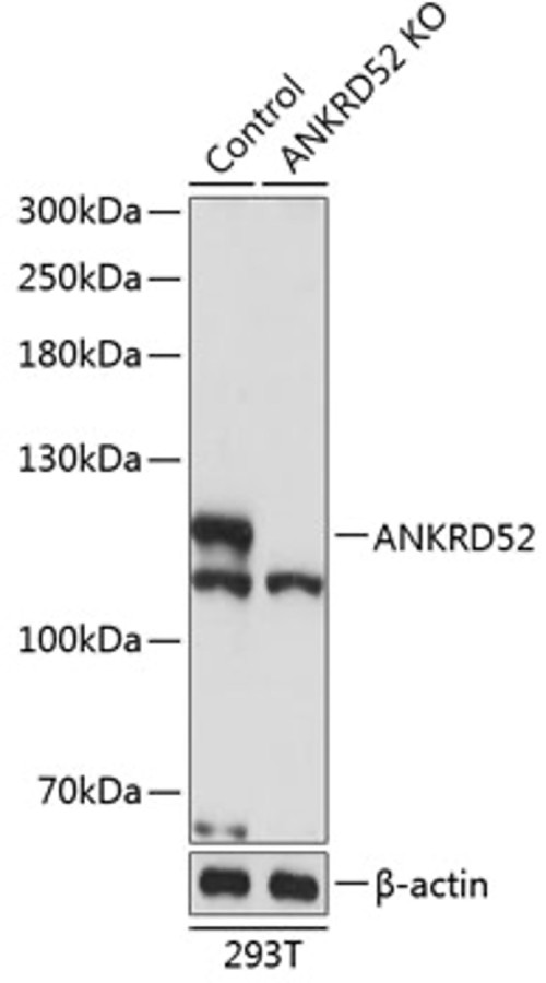 Антитела [KO Validated] ANKRD52 кроличьи, поликлональные, ABclonal