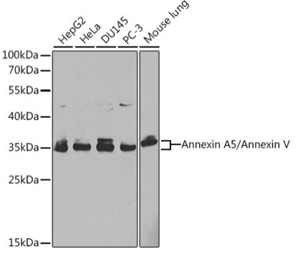 Антитела [KO Validated] Annexin A5/Annexin V кроличьи, поликлональные, ABclonal