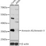 Антитела [KO Validated] Annexin A5/Annexin V кроличьи, поликлональные, ABclonal