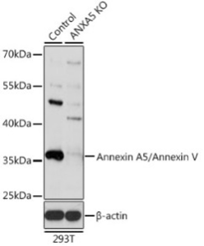 Антитела [KO Validated] Annexin A5/Annexin V кроличьи, поликлональные, ABclonal