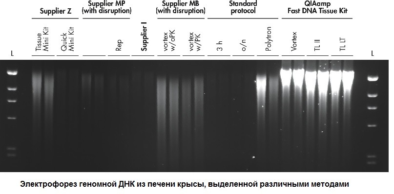 Набор для выделения ДНК из тканей QIAamp Fast DNA Tissue Kit, Qiagen