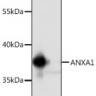 Антитела [KO Validated] ANXA1 кроличьи, поликлональные, ABclonal