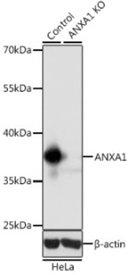 Антитела [KO Validated] ANXA1 кроличьи, поликлональные, ABclonal