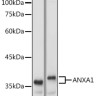 Антитела [KO Validated] ANXA1 кроличьи, поликлональные, ABclonal