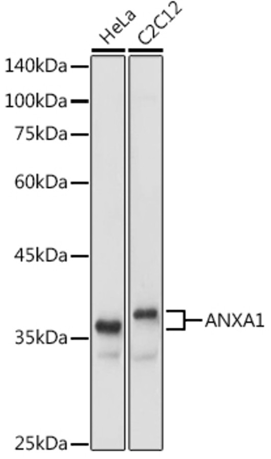 Антитела [KO Validated] ANXA1 кроличьи, поликлональные, ABclonal