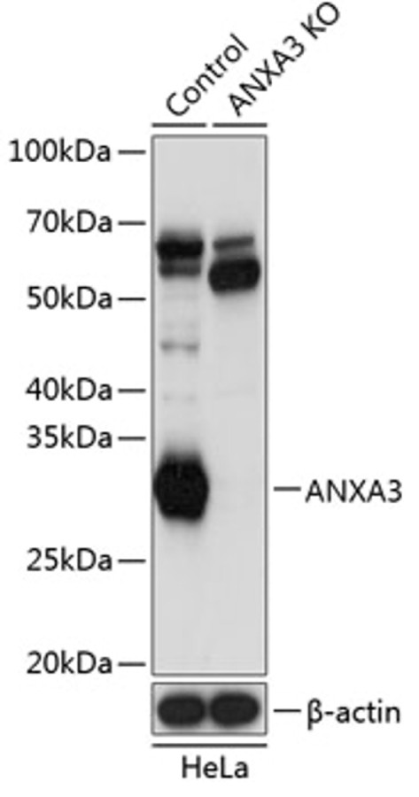 Антитела [KO Validated] ANXA3 кроличьи, поликлональные, A19861, ABclonal