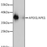 Антитела [KO Validated] APEX1/APE1 кроличьи, поликлональные, ABclonal