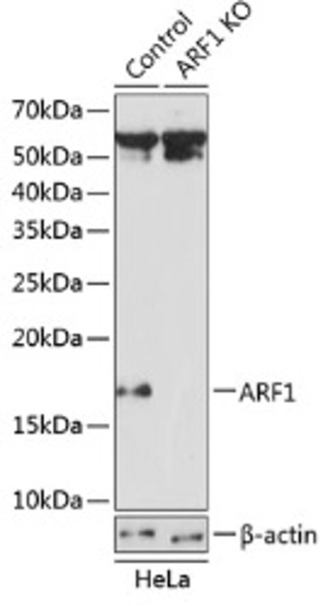 Антитела [KO Validated] ARF1 кроличьи, поликлональные, ABclonal