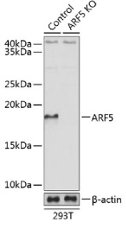 Антитела [KO Validated] ARF5 кроличьи, поликлональные, ABclonal