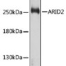 Антитела [KO Validated] ARID2 кроличьи, поликлональные, ABclonal