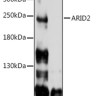 Антитела [KO Validated] ARID2 кроличьи, поликлональные, ABclonal