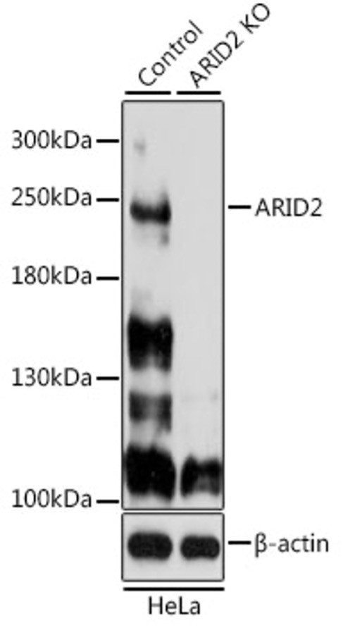 Антитела [KO Validated] ARID2 кроличьи, поликлональные, ABclonal