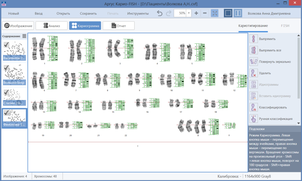 ПО для автоматического анализа хромосом, кариотипирования, Аргус-Karyo, АргусСофт