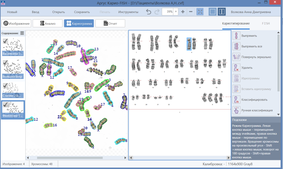 ПО для автоматического анализа хромосом, кариотипирования, Аргус-Karyo, АргусСофт