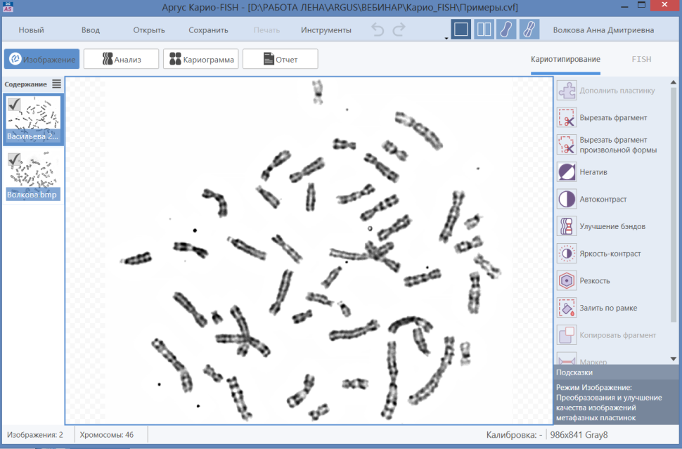 ПО для автоматического анализа хромосом, кариотипирования, Аргус-Karyo, АргусСофт