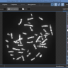 ПО для автоматического анализа хромосом, кариотипирования, Аргус-Karyo, АргусСофт