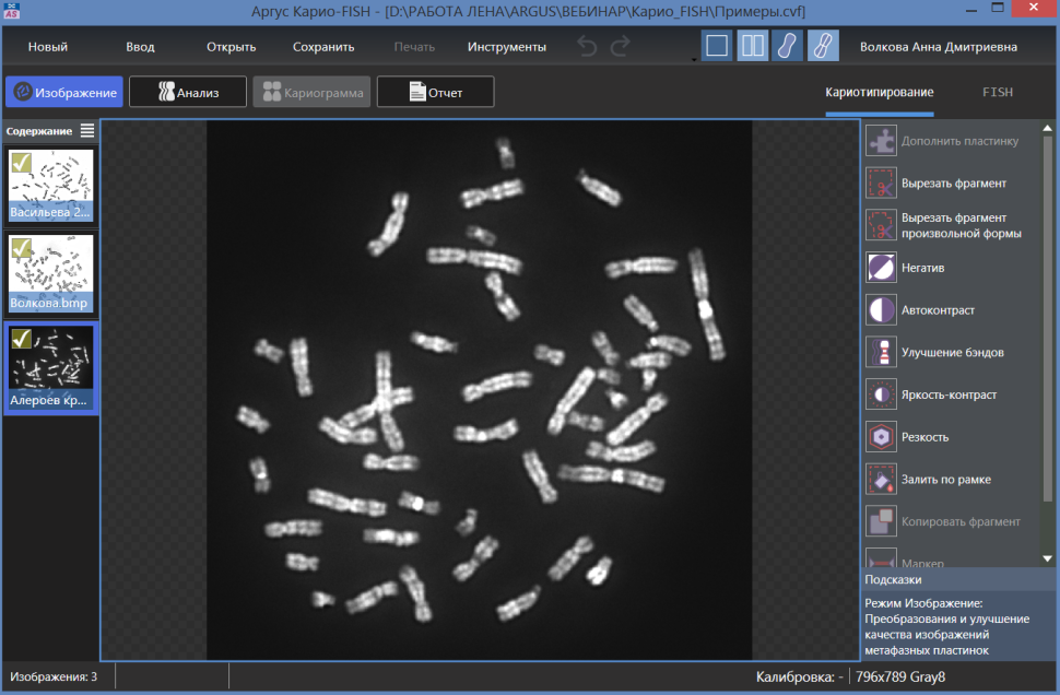 ПО для автоматического анализа хромосом, кариотипирования, Аргус-Karyo, АргусСофт