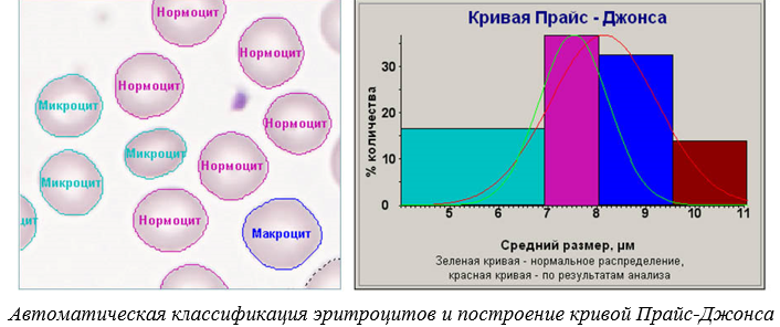 ПО для анализа крови, лейкоцитарная формула, эритроцитометрия, подсчет тромбоцитов, Аргус-Blood, АргусСофт