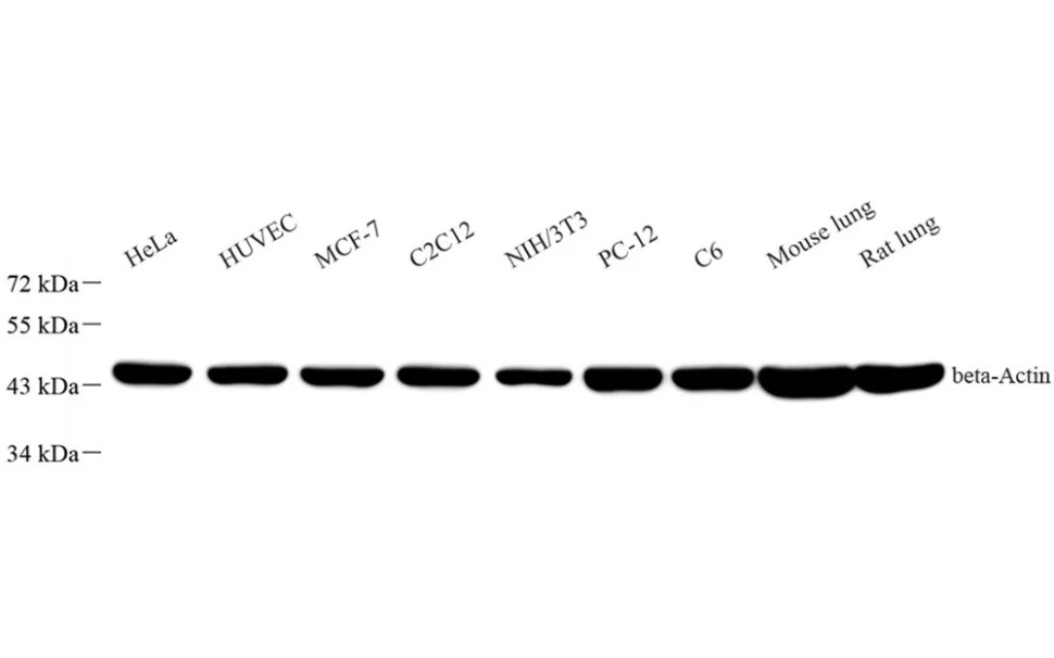 Антитела Anti - beta Actin, мышиные моноклональные, рекомбинантные, Servicebio, Китай