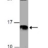 Антитела Anti-Cystatin C antibody, кроличьи поликлональные, Abcam