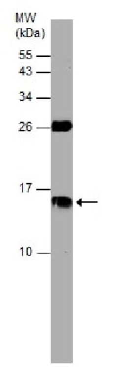 Антитела Anti-Cystatin C antibody, кроличьи поликлональные, Abcam