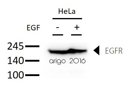 Антитела anti-EGFR antibody, мышиные моноклональные, Arigobio